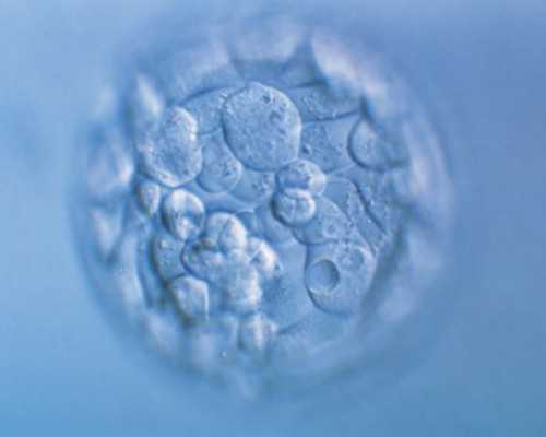 染色体异常胎停了_高龄孕妇怀孕,2023
天津卵巢早衰试管婴儿排名，供卵助孕机